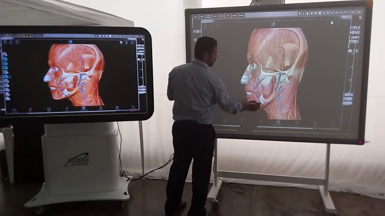 Cresce uso de impressão 3D na medicina