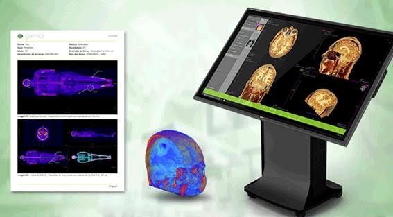 ENG amplia mercado de mesa digital de anatomia