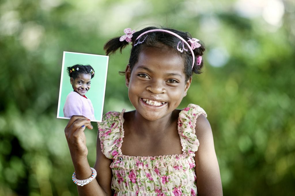 Operação Sorriso dá esperança e dignidade às crianças com ajuda de tecnologia
