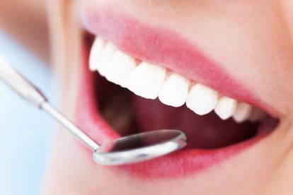 Mercado de implantes dentários movimentou R$ 850 milhões no Brasil